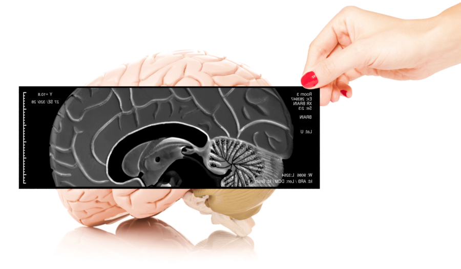 La formation de Pathologies ASCA traite largement des pathologies du système nerveux