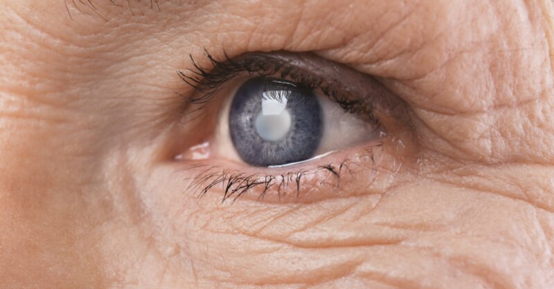 Image blog glaucome